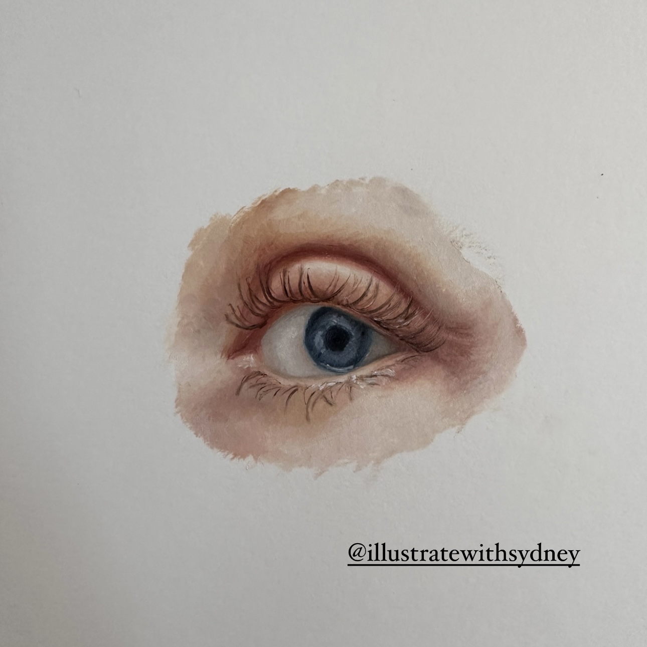 Eye